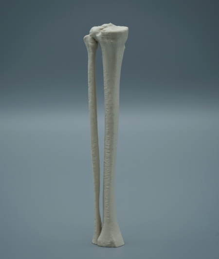 Oefen Botmodel – Proximale Tibia Pediatric